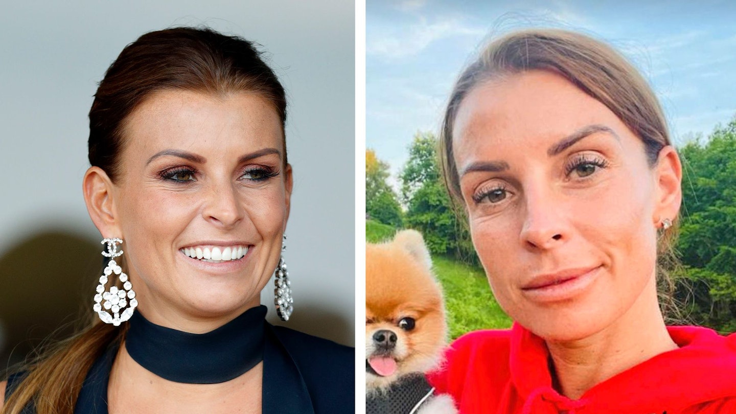 coleen rooney before and after