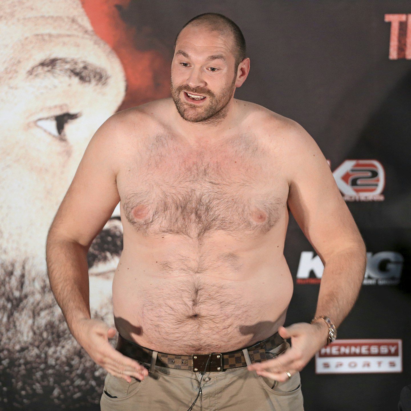 tyson fury then