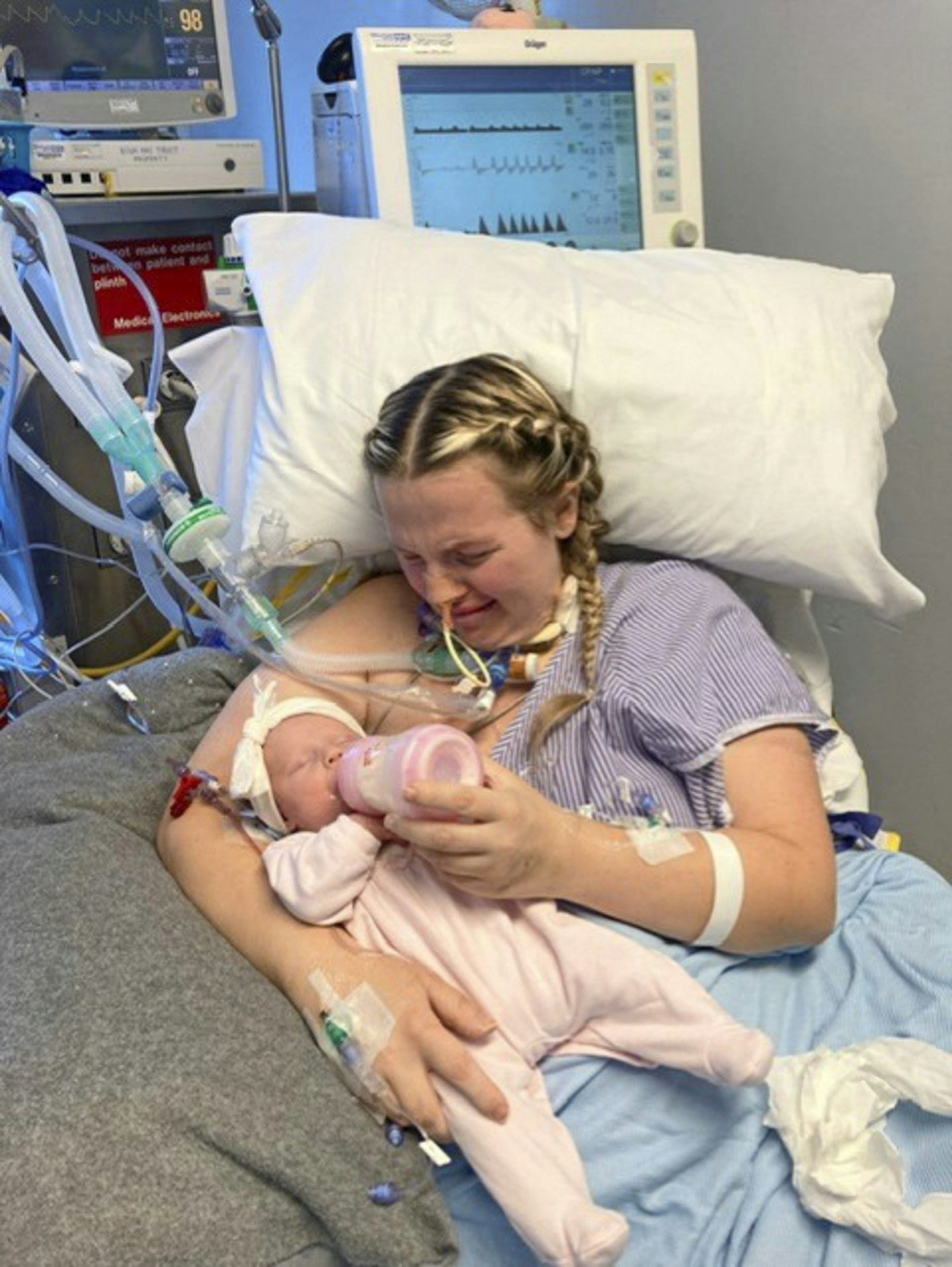 mum gives birth in coma after covid