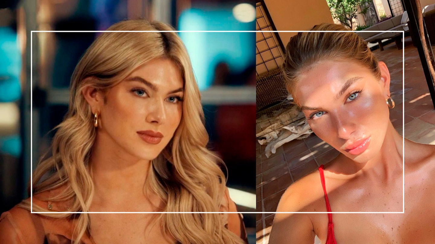 Did Nicole Berry Made In Chelsea Cast Undergo Plastic Surgery? Did Nicole Berry Made In Chelsea Cast Undergo Plastic Surgery?