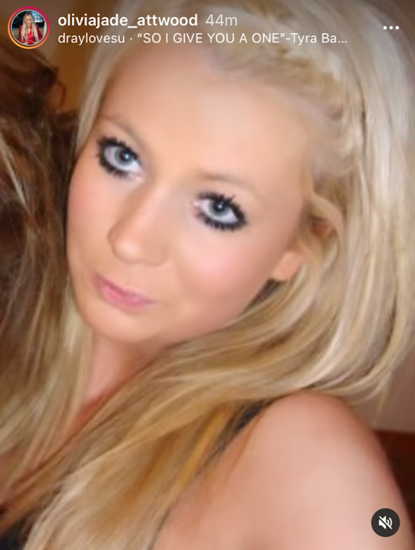 Olivia Attwood before fillers
