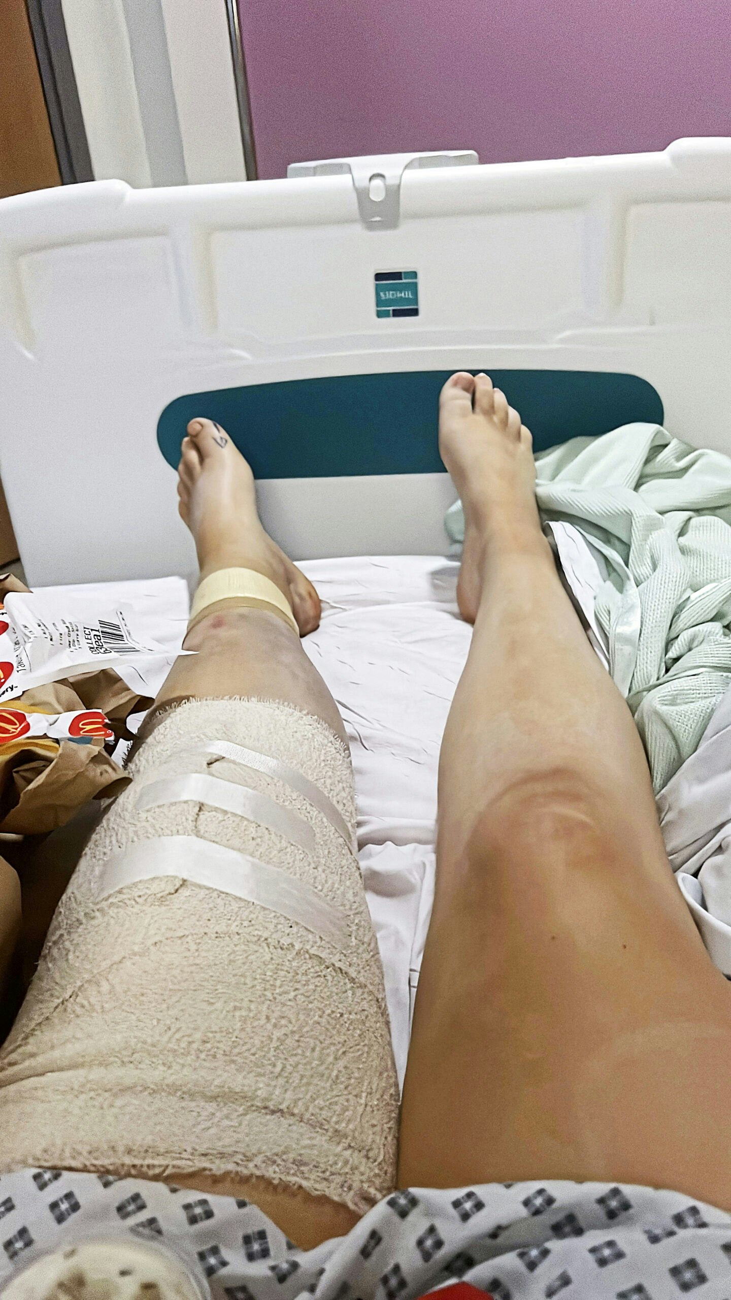 Leg snapped in half after jumping off pier
