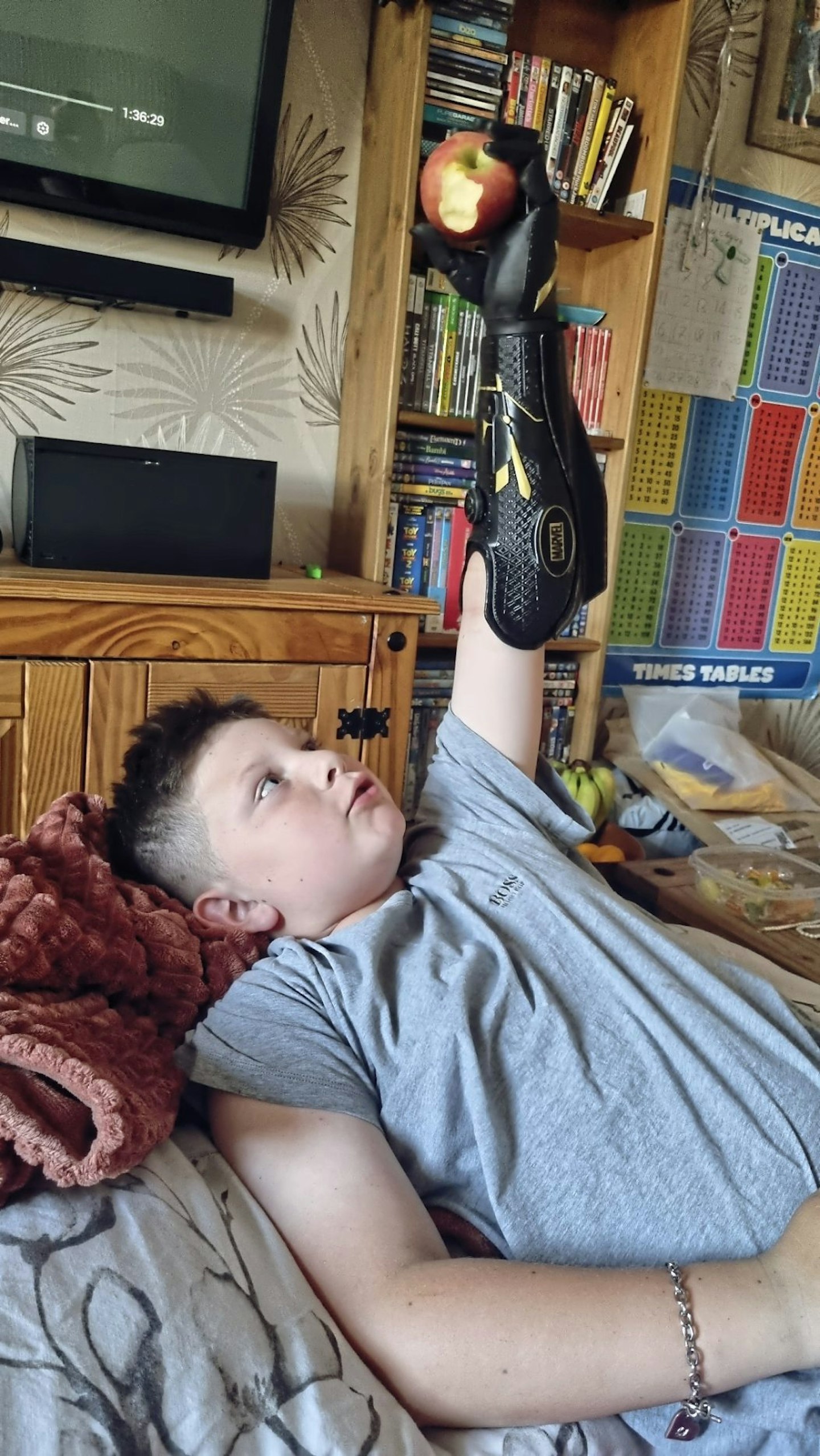 My son's bionic arm