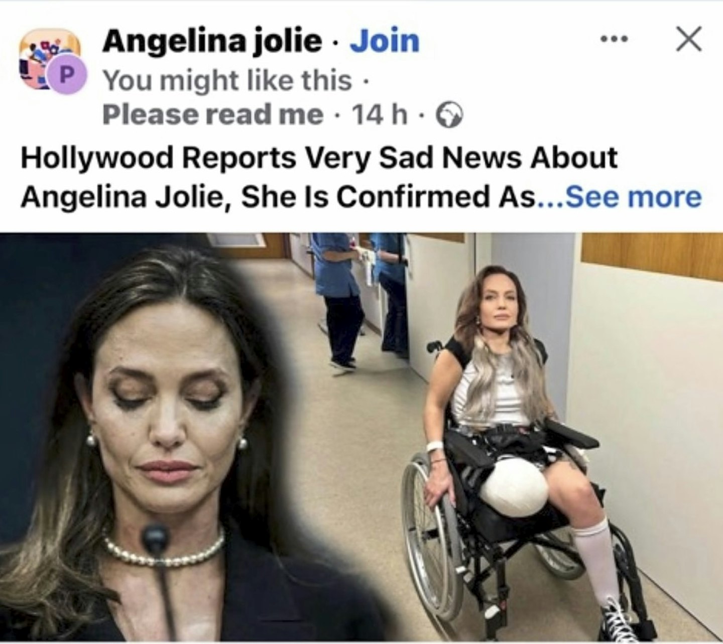 That's Jolie crazy!