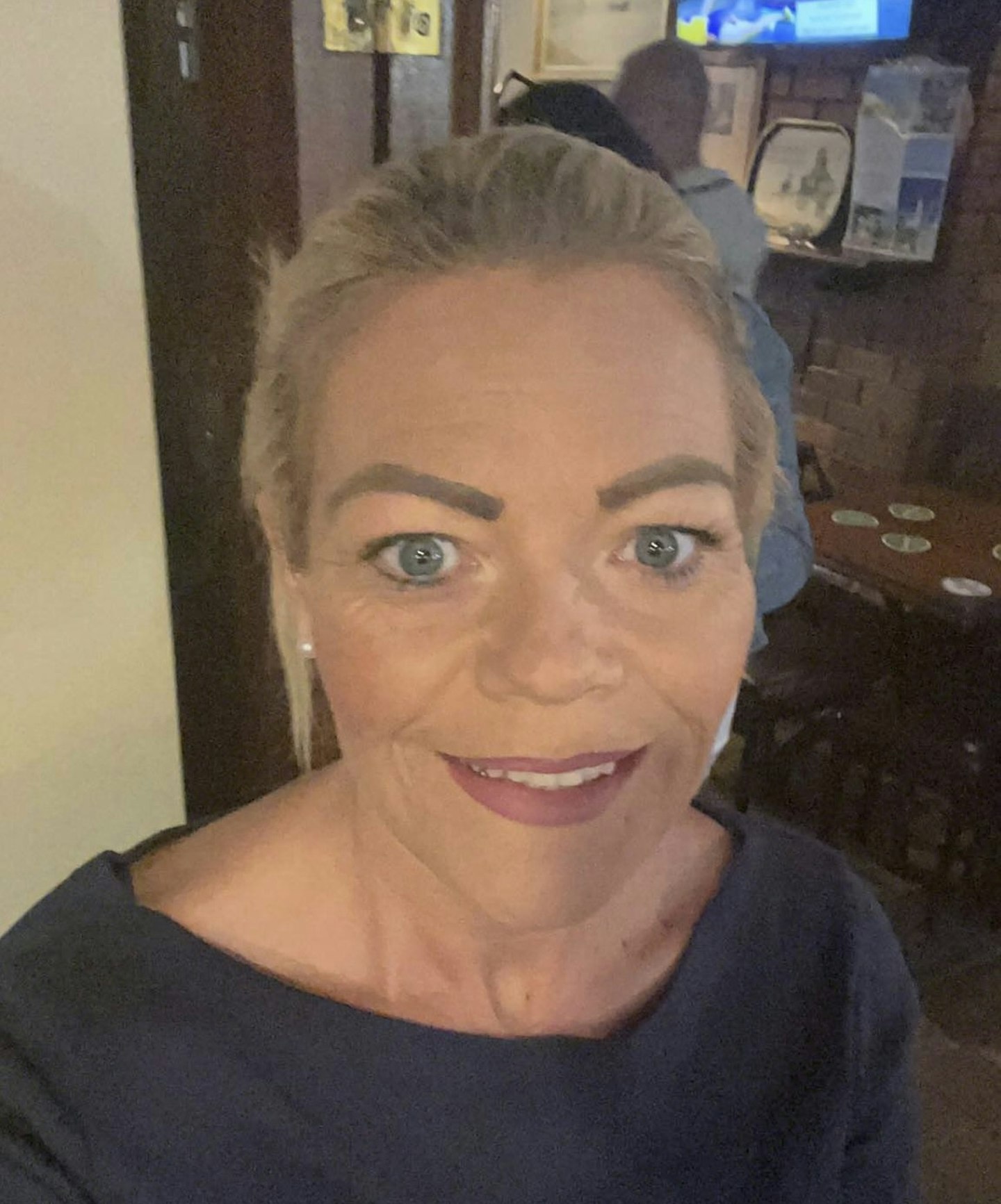botched surgery