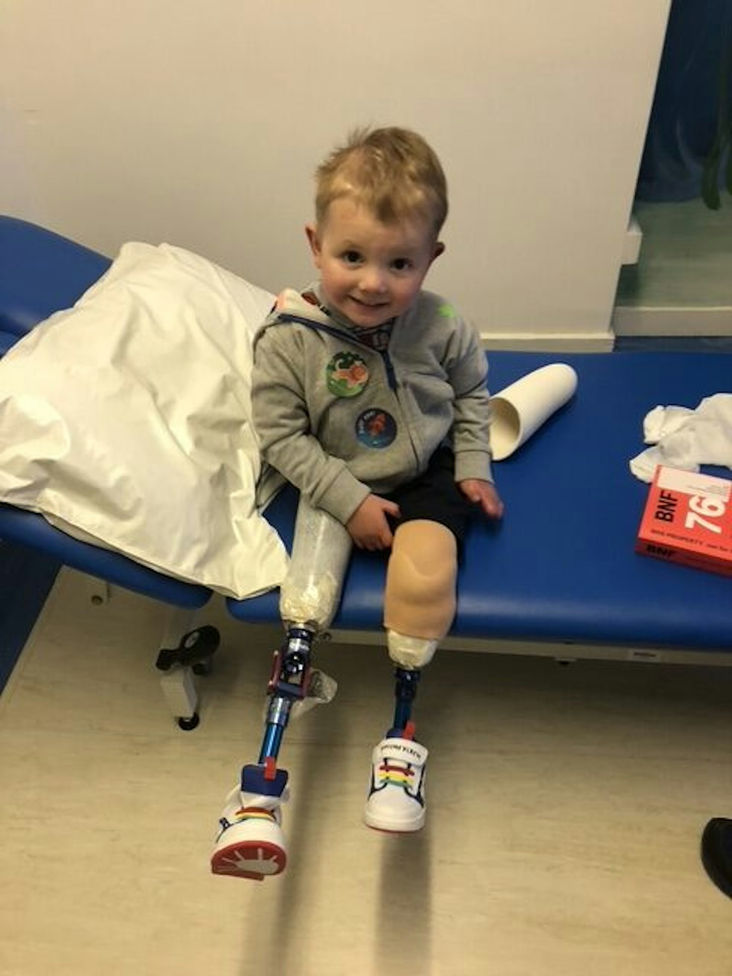 Lost legs to sepsis