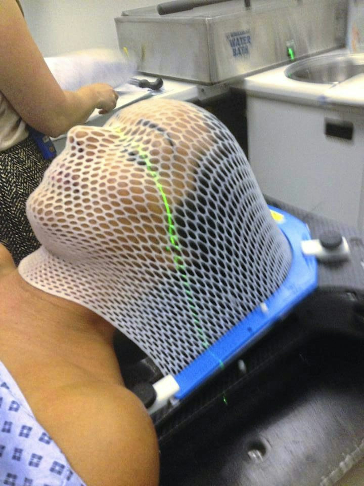 baby after tumour