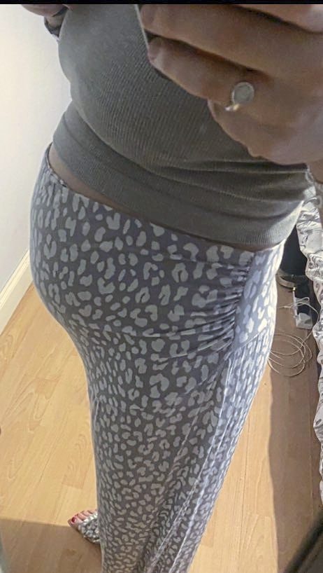 kidney infection was surprise baby