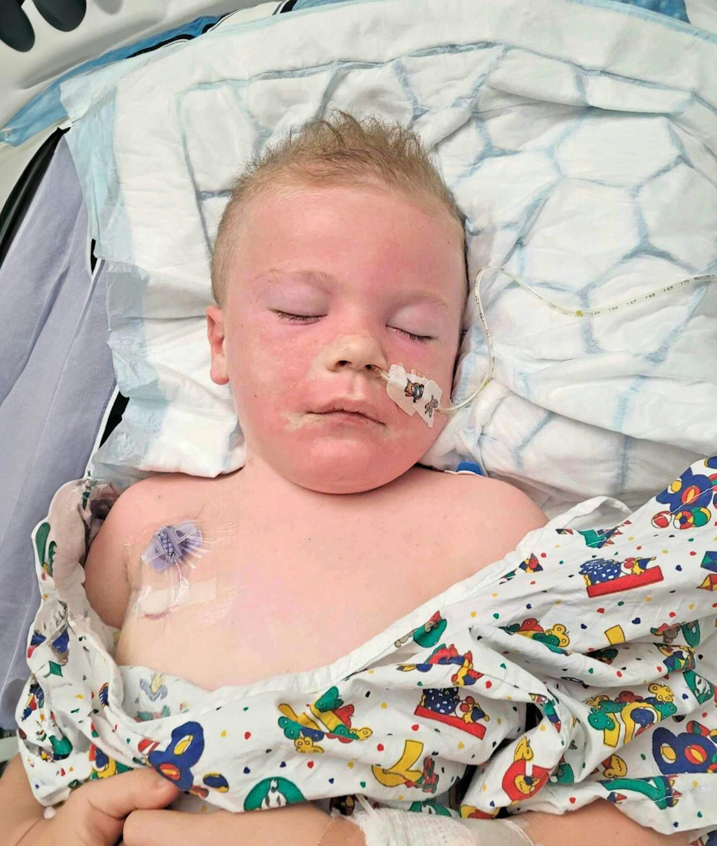 Cancer diagnosis after fall