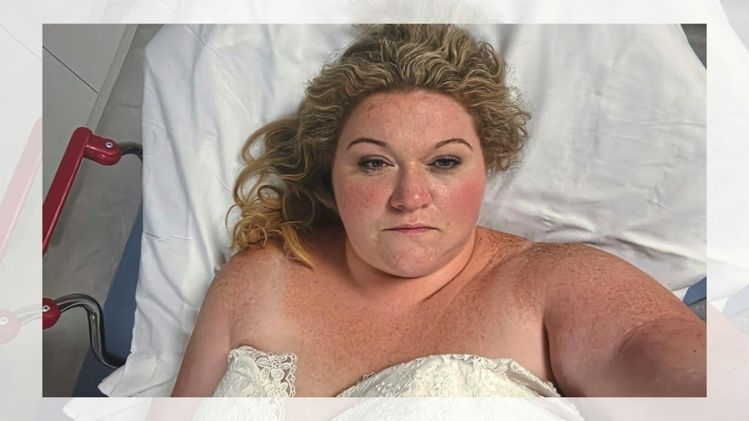 bride broke leg