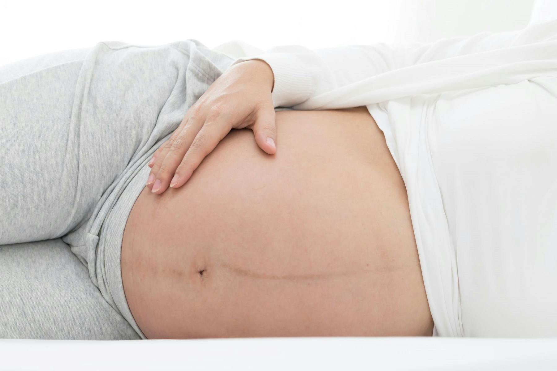 pregnancy line on stomach gender
