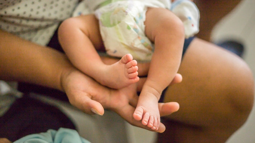Clubfoot In Babies Cause Symptoms And Treatments Baby Mother Baby Clubfoot In Babies Cause Symptoms And Treatments Baby Mother Baby