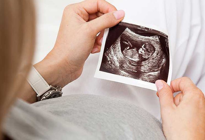 Baby boy scan pictures at 12 weeks